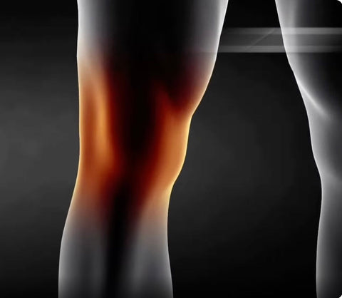 Tib Bar Raises and Knee Pain: Clearing Up the Misunderstanding
